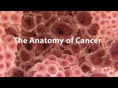 What Is Cancer? What Causes Cancer &amp; How Is It Treated?