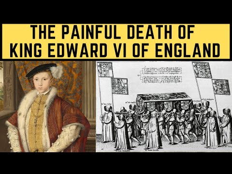 The PAINFUL Death Of King Edward VI Of England - The Boy Tudor King