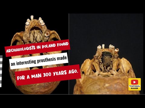 Archaeologists in Poland found an interesting prosthesis made for a man 300 years ago.