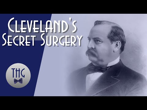 Grover Cleveland&#039;s Secret Surgery