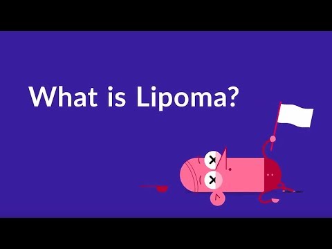 What is Lipoma? (Fat Lump Under Skin)