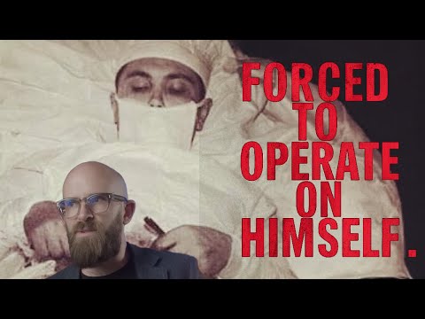 The Man Who Removed His Own Appendix