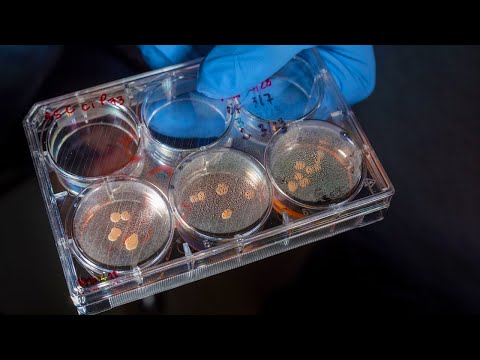 Scientists grow mini brains with eyes in lab || mini brain with eyes