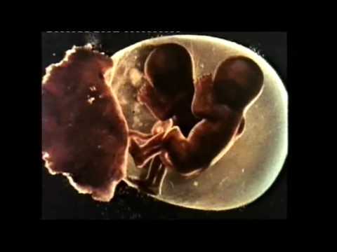 Sisters (1973) - Trailer