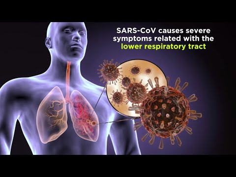 Severe Acute Respiratory Syndrome (SARS)