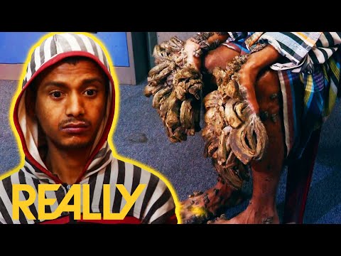 “The Tree Man From Bangladesh” | Body Bizarre