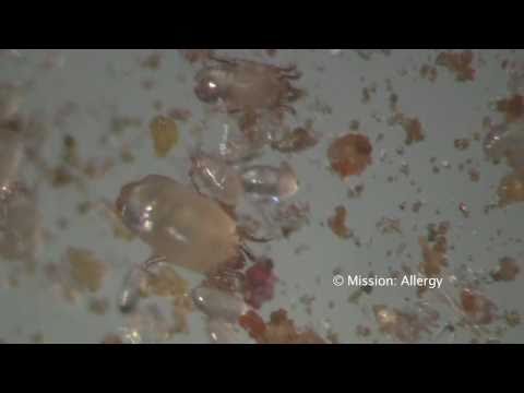 Dust Mites under the Microscope, in Hi-Def.mov