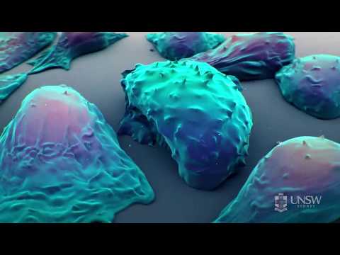 Nanoparticle-based drug delivery in the fight against cancer