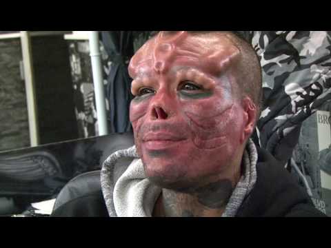 10 Bizarre Body Modifications People Actually Do - 73