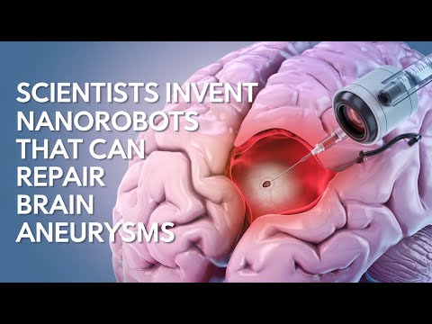Scientists Invent Nanorobots That Can Repair Brain Aneurysms – Medical Breakthrough