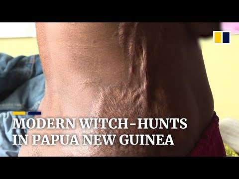 Modern witch-hunts in Papua New Guinea