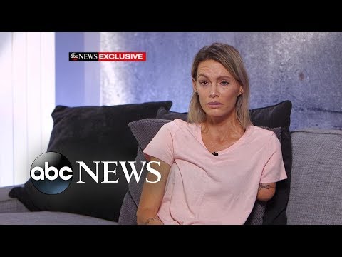&#039;Resident Evil&#039; stuntwoman speaks out about injury, lawsuit l ABC News