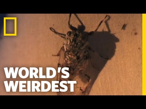 Larva Removed from a Girl&#039;s Scalp | World&#039;s Weirdest