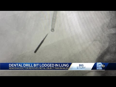 Patient inhales 1-inch dental drill bit