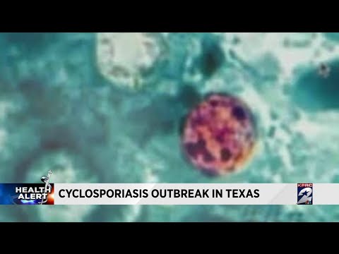 Cyclosporiasis outbreak in Texas