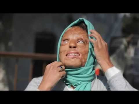 Ten Blood Curdling Acid Attacks - 95