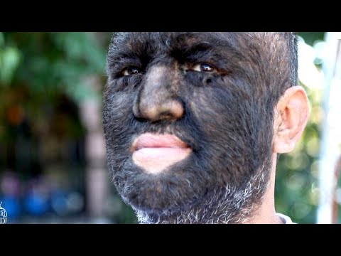 Meet the World&#039;s Hairiest Man