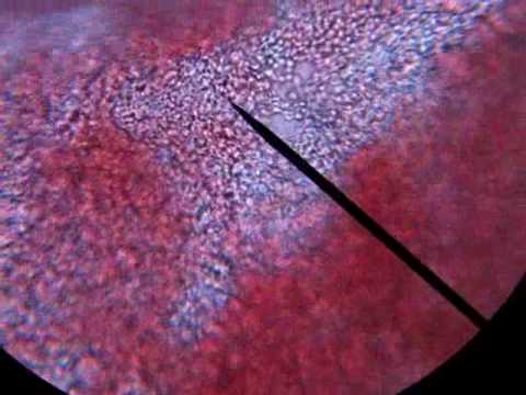 Blood Cells Flowing in Microscope
