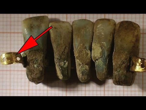 400 Year Old False Teeth Found In Italy | Archaeological Discoveries
