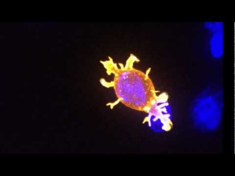 Killer T cell attacking cancer