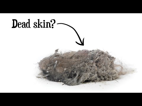 Top 10 Grossest Facts About Human Skin - 96