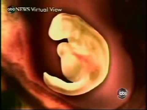Medical mysteries foetus in fetu