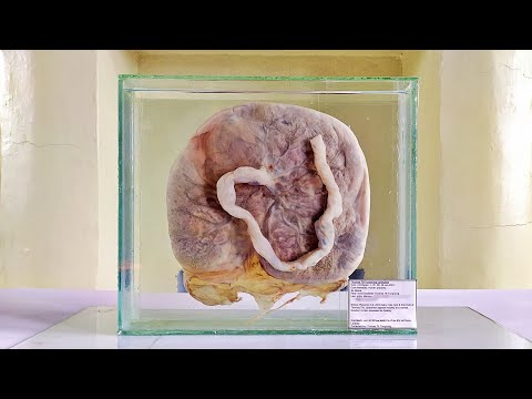 Wet Specimen Tutorial | Preserving a Placenta