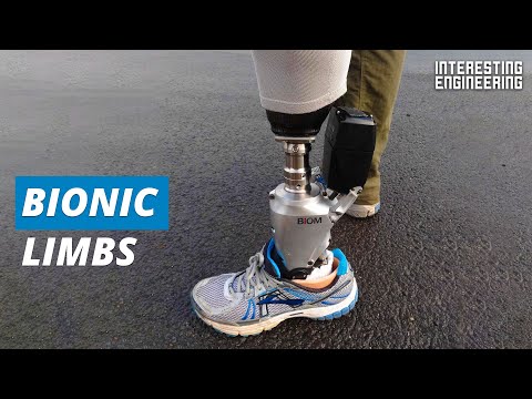Bionics are the future of prosthetics