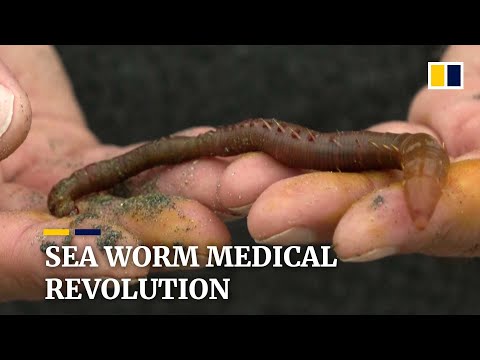 Sea worm oxygen-saving technology may preserve organs before transplants