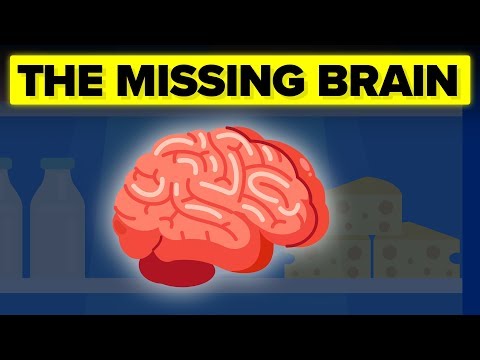 The Insane Mystery Surrounding JFK&#039;s Missing Brain