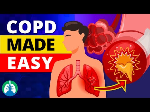 COPD Explained - Types, Causes, Symptoms, and Treatment ❗