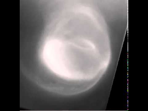 Venus&#039; South Polar Vortex