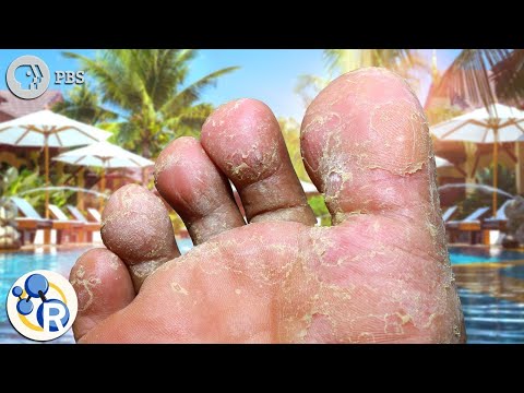 Top 10 Gross Things You Can Find On Your Body - 77