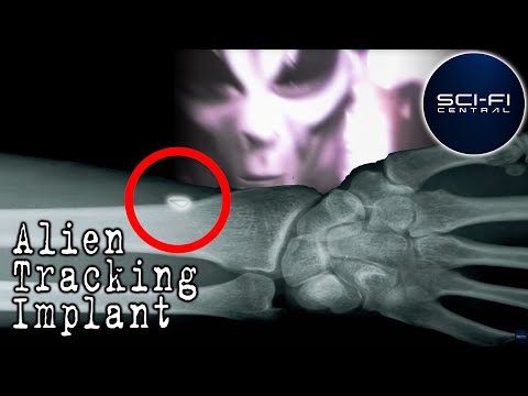 Alien Implants | Alien Mind Control | Weird Or What? | S3EP10 | William Shatner