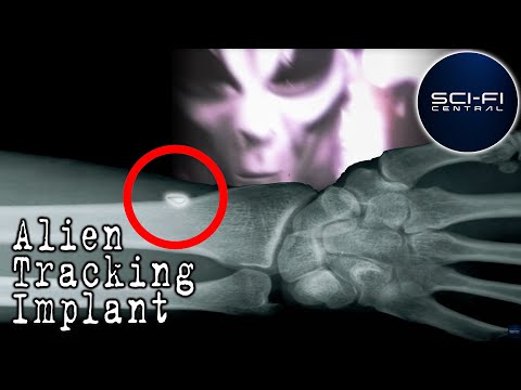 10 Signs You Might Have Already Been Abducted by Aliens - 27