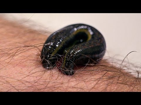 How Leeches are used in Modern Surgery | Earth Lab