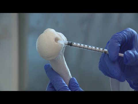 Chicago scientists develop revolutionary cartilage regeneration technology