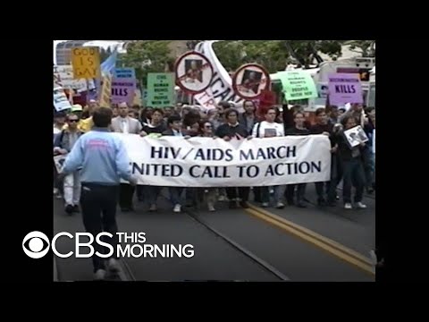 Reflecting on the AIDS epidemic on the 40th anniversary of the first reported cases