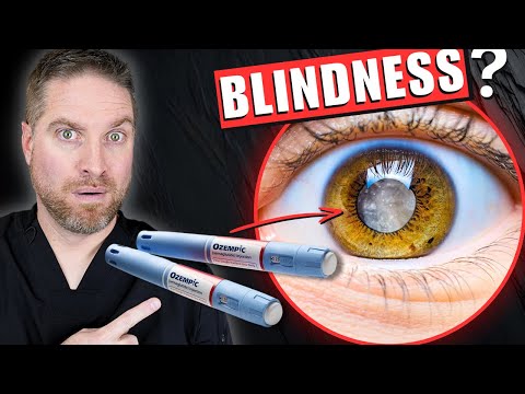 Ozempic and Wegovy Side Effects Linked To BLINDNESS?