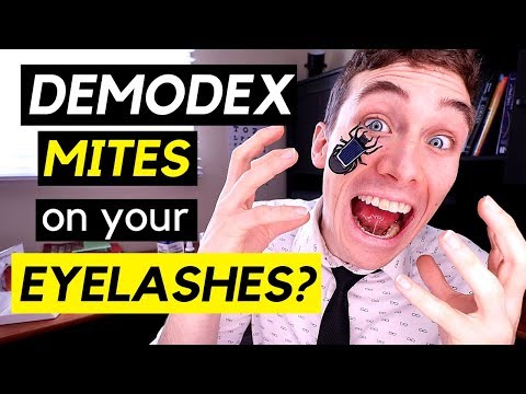 Demodex Mites on Eyelashes? - How to get rid of Demodex Mites