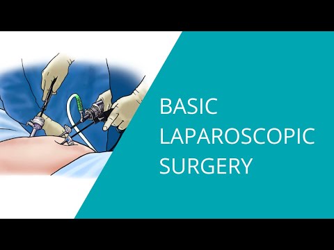 Basic Laparoscopic Surgery