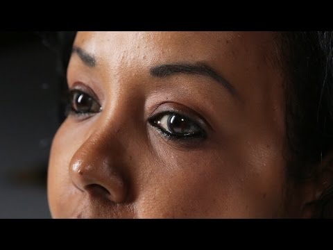 How I Survived Female Genital Mutilation