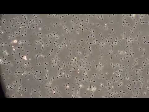 World&#039;s oldest semen under microscope - University of Sydney