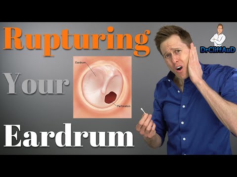 Ruptured Eardrum | Tympanic Membrane Perforations