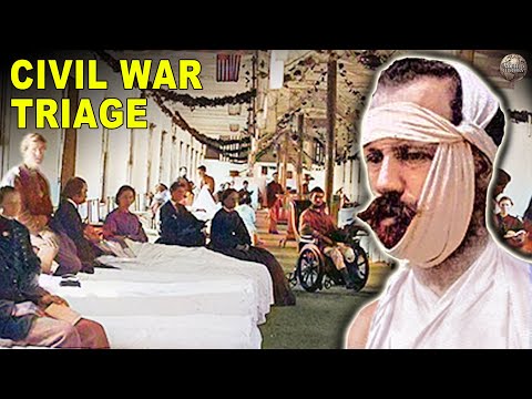 What It Was Like Working in a Civil War Field Hospital