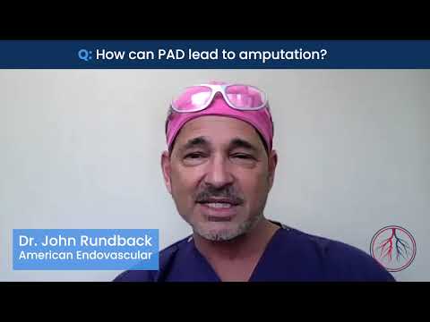 How does PAD lead to amputation?