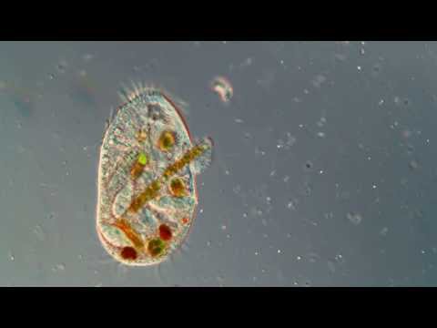 Protozoan With Diatoms. IIC, 500X. Amazing High Definition Microscopy Video! 1080P!