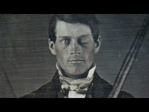 Why Scientists Are Still Fascinated By Phineas Gage