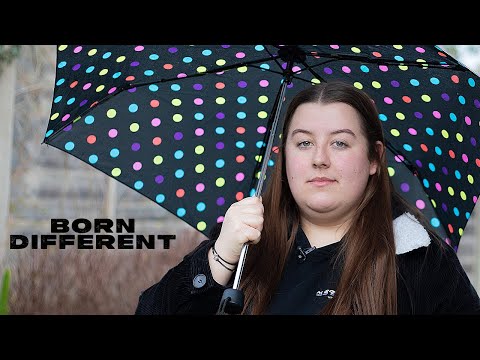 I&#039;m Allergic To Water - And People Ask Me If I Shower | BORN DIFFERENT