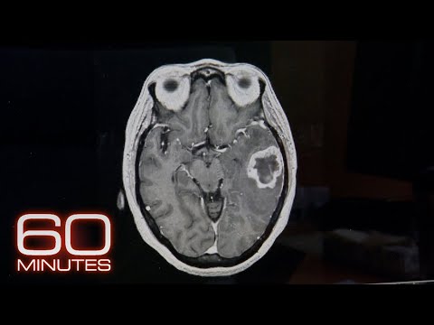 Frontotemporal Dementia | 60 Minutes Archive